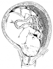 Term Fetus